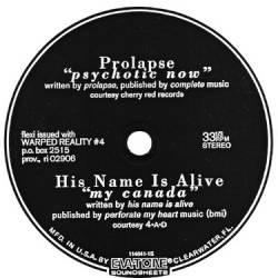 Prolapse : Split with His Name Is Alive